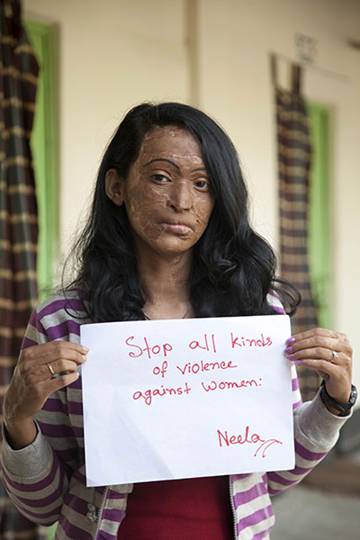 ASN: Acid Survivors Network in Bangladesh