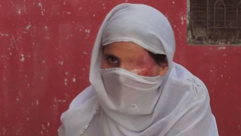 A screen grab from the documentary Saving Face showing one of the Pakistani women featured in the film. The documentary profiles women who have been disfigured as a result of acid being thrown on them, usually by a relative.