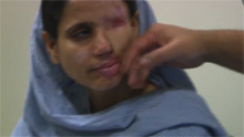 Plastic surgeon Mohammad Jawad touches the face of a victim of an acid attack in Pakistan in this screen grab from the documentary Saving Face.