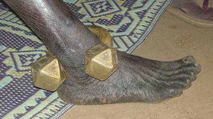 Ankle bracelet slaves are forced to wear. Photo: Anti-Slavery International