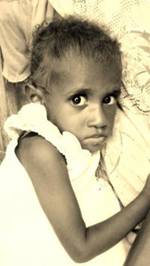 Child suffering from severe malnutrition, Zanegi village, Merauke Regency, Papua Province, Indonesia, May 2013