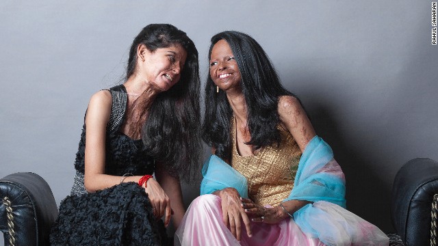 Ritu (L) and Laxmi live in Chavvn, one of the few shelters for acid attack survivors in India.