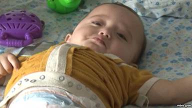 A child being treated for a birth defect at a hospital in Tajikistan's Khatlon region.